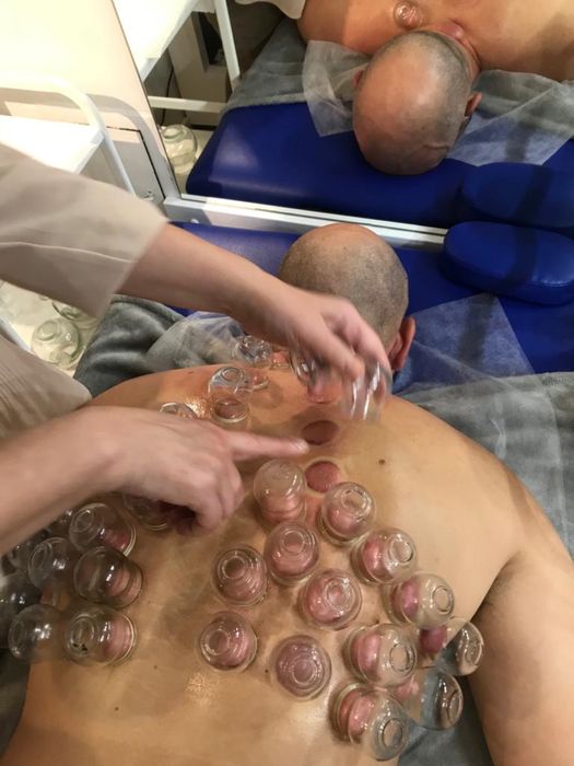 Stawianie baniek ogniowych lekarskich Dojazd do Pacjenta