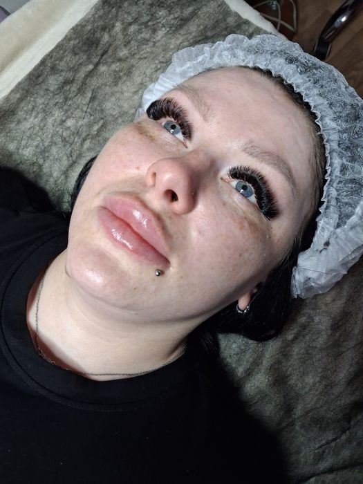 Косметолог Кривой Рог(губы, ботокс,чистка лица)