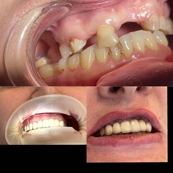 Услуги стоматолога г.Харьков