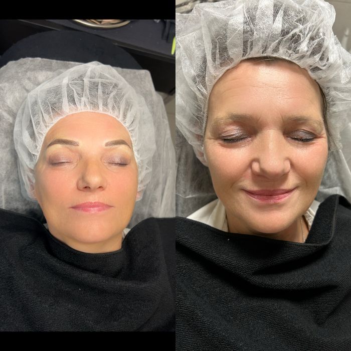 Podkreśl swoje piękno – teraz z 20% rabatem!