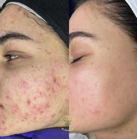 косметична хіджама