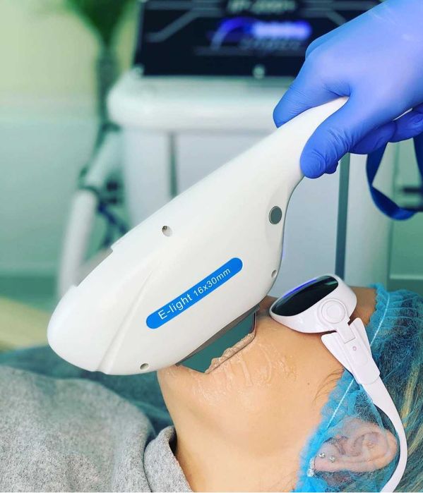 Фотоэпилятор IP-200+ ALVI Код: IP-200+ ALVI