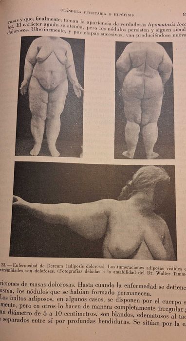 Medicina Endocrinologia - Edição dos aos 40