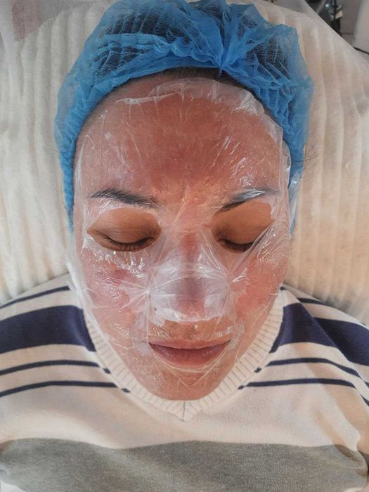 Косметолог Лівобережна чистка, карбоксі, пілінг, фракційна мезотерапія