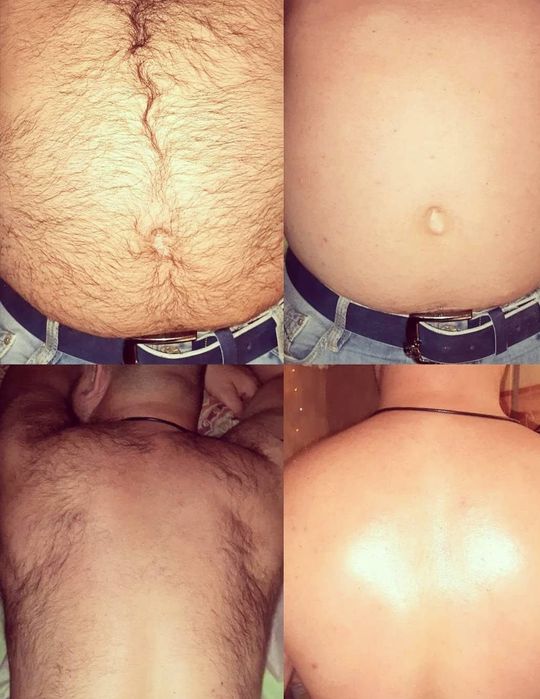 Депіляція, шугаринг  чоловіча,тример Борщагівка ЖК Парко