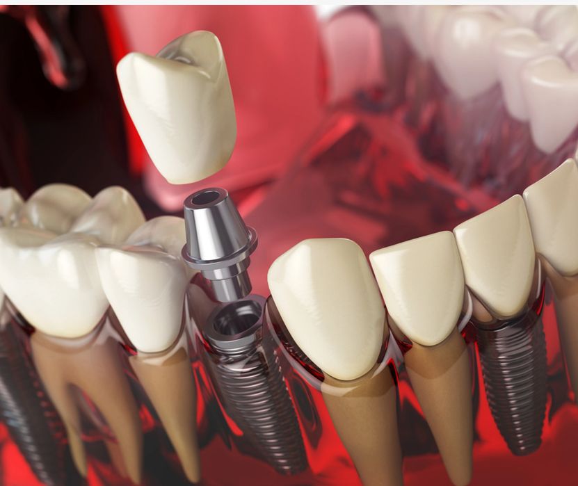 Sorriso brilhante e confiante sem dor de ouvido