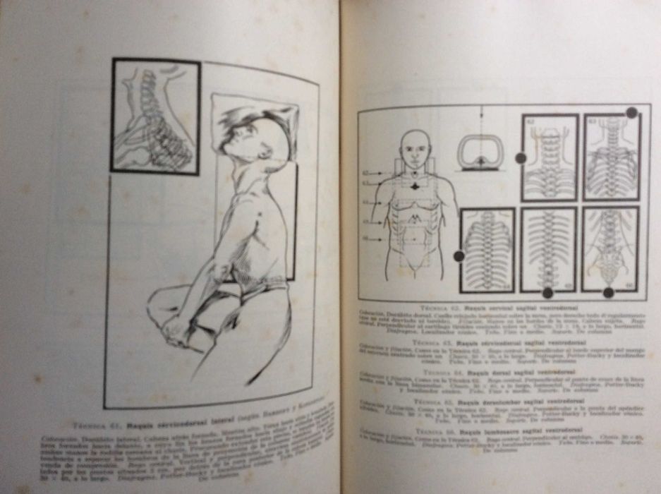 Técnica de la exploración roentgenoscópica y roentgenográfica , 1944