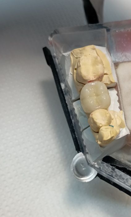 Зубний Технік /Металокераміст