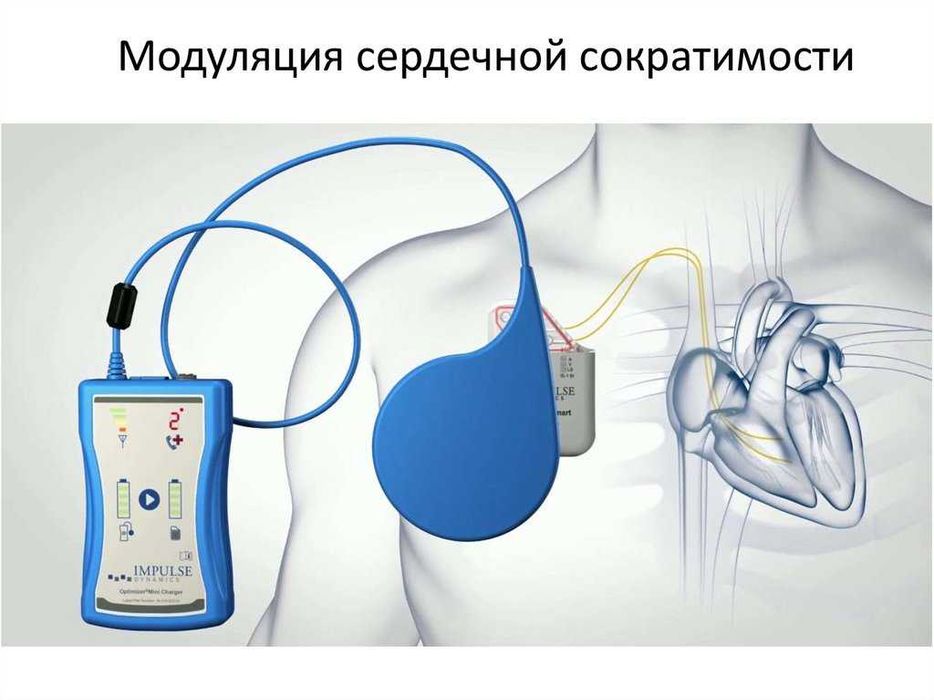 Impulse Dynamics Зарядное OPTIMIZER Mini Charger сердечного импланта