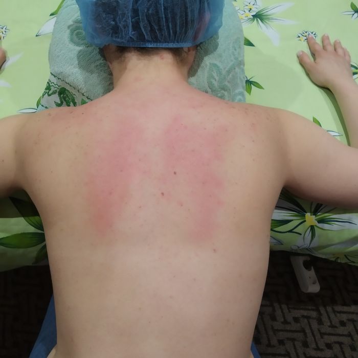 Массаж Шевченковский район.. Масаж Шийно-комірцева зона