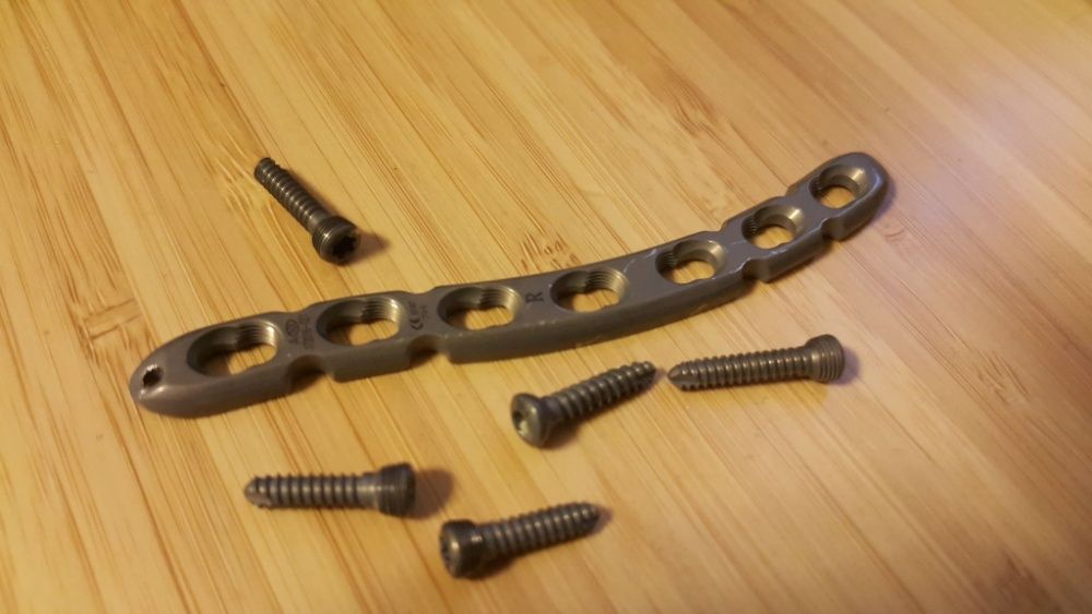 Титанова пластина для ключиці