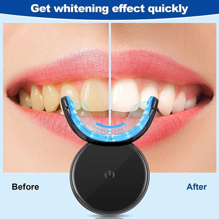 (NOVO) Conjunto de branqueamento dental