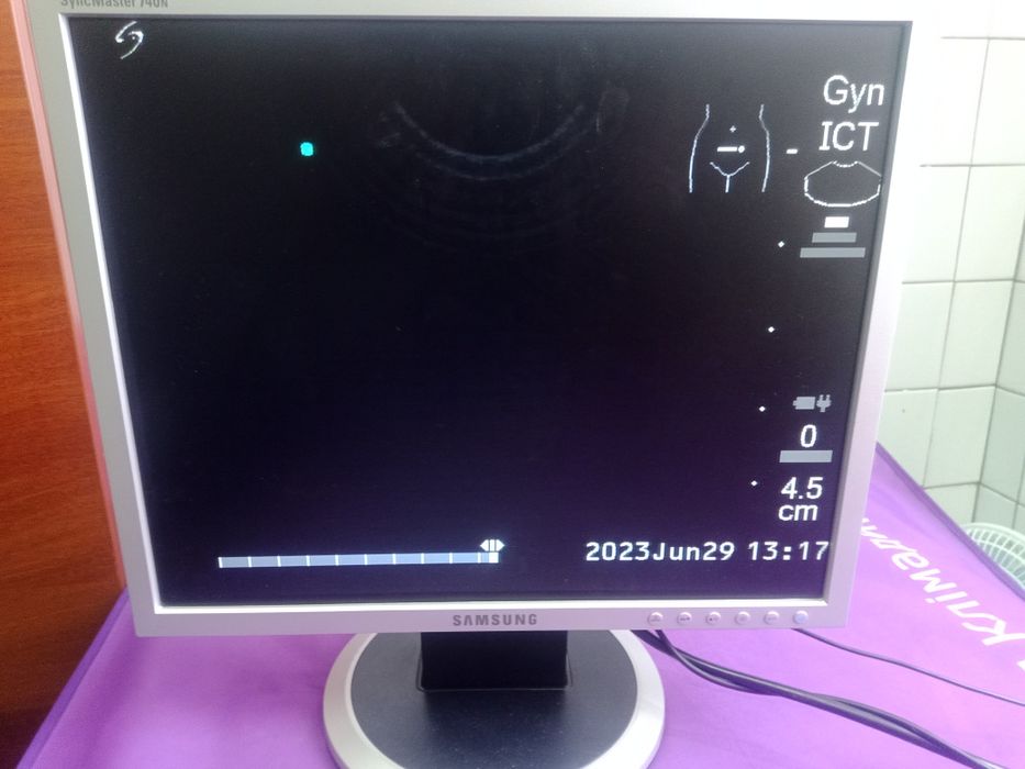 Монітор для УЗ- апарату SonoSite 180s 15"