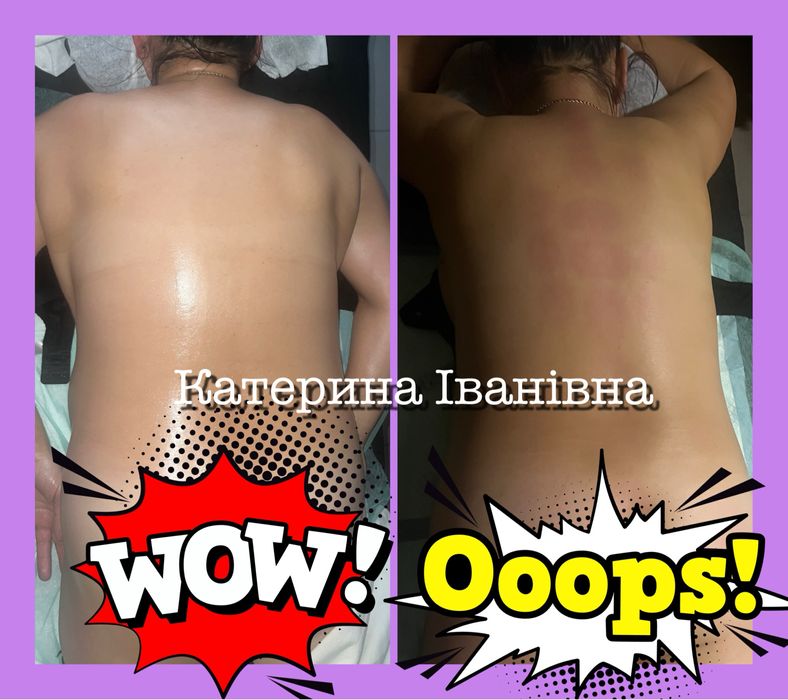 Масаж  та реабілітація!Стоун терапія лімфодренаж пресотерапія