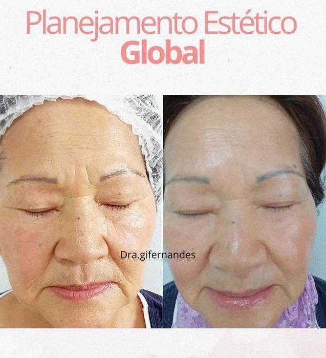 Estética Facial e Corporal Avançada/ EXCLUSIVO para MULHERES