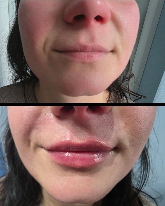 Promocja Borox 1 okolica 130zł