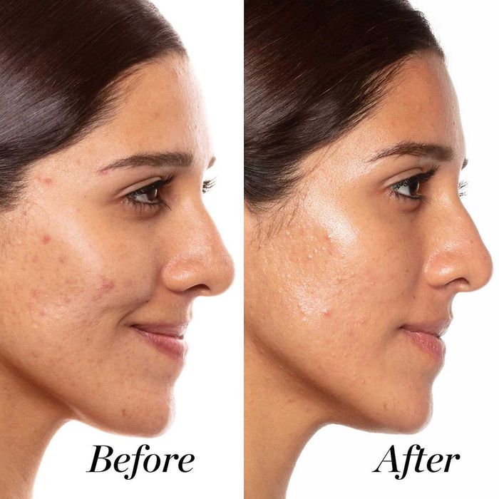 Serum z retinoidów - SUNDEY RILEY A+ High Dose Retinoid