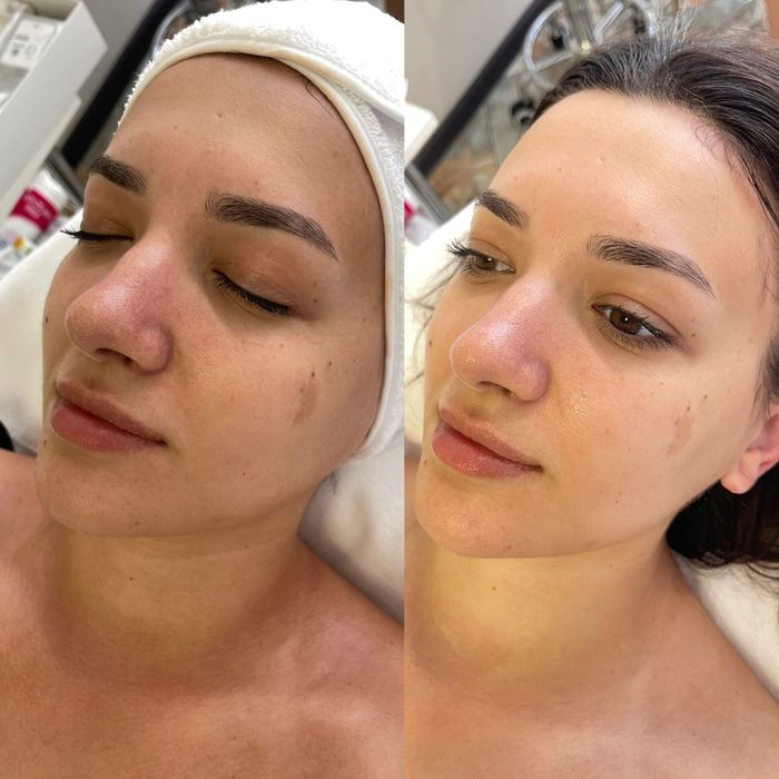 Косметолог:Чистка, пілінг,біоревіталізація, Позняки Драгоманова 2-Б