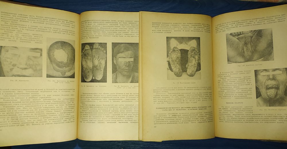книги: Кожные и венерические болезни.  авт.: Проф. А.И.Картамышев 1953