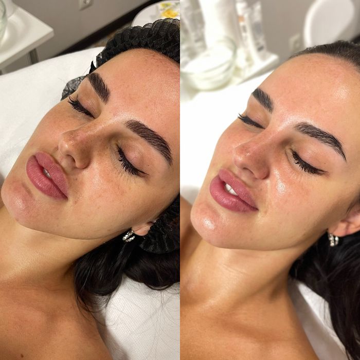 Косметолог:Чистка, пілінг,біоревіталізація, Позняки Драгоманова 2-Б