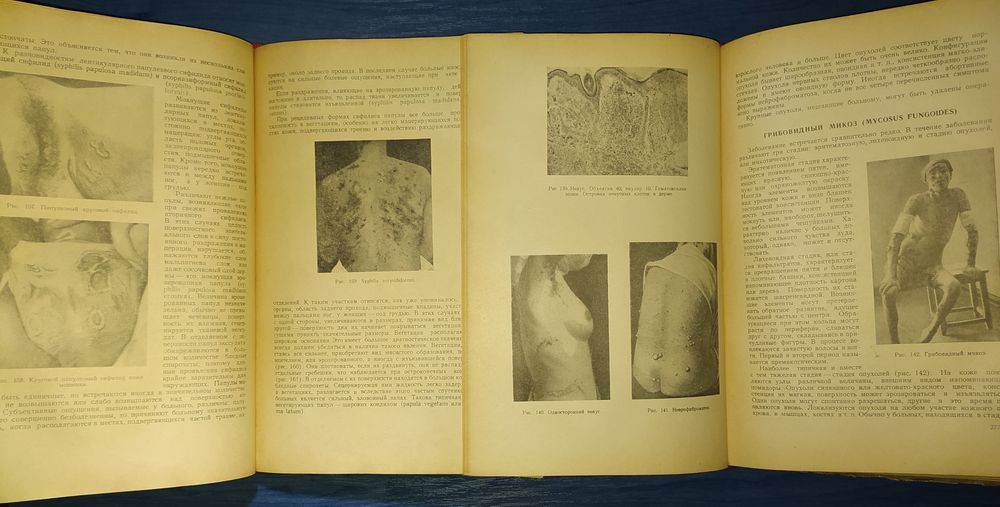 книги: Кожные и венерические болезни.  авт.: Проф. А.И.Картамышев 1953
