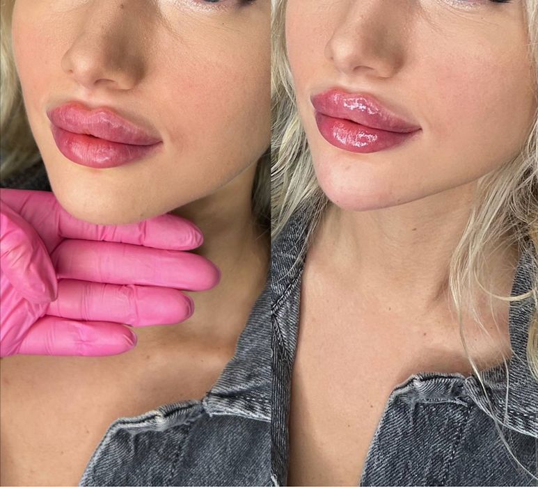 Косметолог одесса таирова