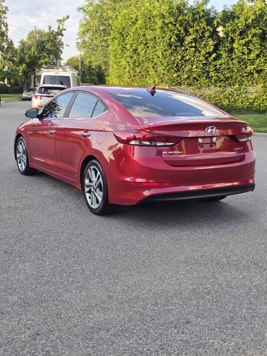Hyundai Elantra      2017