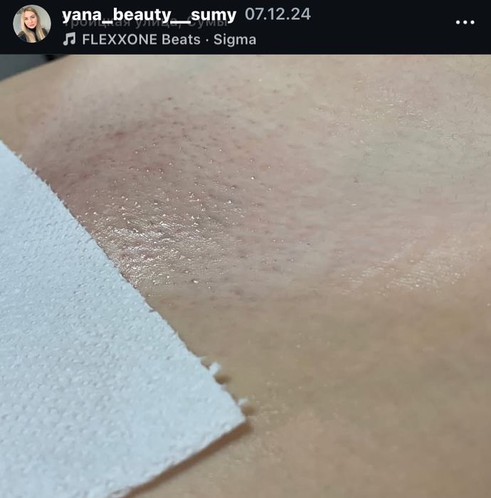 Жіночий Шугаринг | Троїцька | Центр