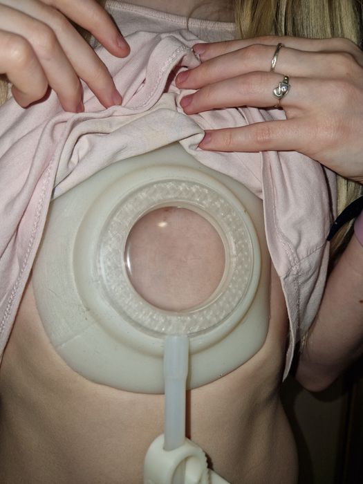 Индивидуальный Vacuum bell, вакуумный купол(колокол, дзвін, Белл).ВДГК