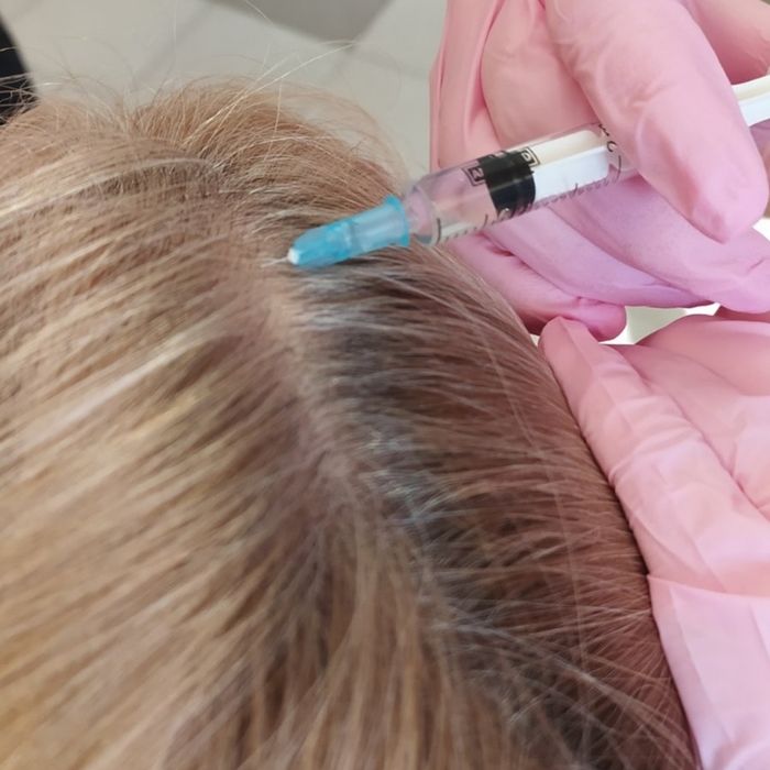 Косметолог.Увеличение губ  ,Чистка лица,Мезотерапия ,Плазмолифтинг.