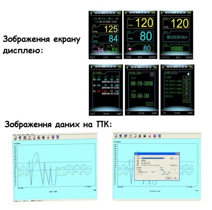 Сфігмоманометр CONTEC08A-VET, ветеринарний тонометр (АТ та кисень)