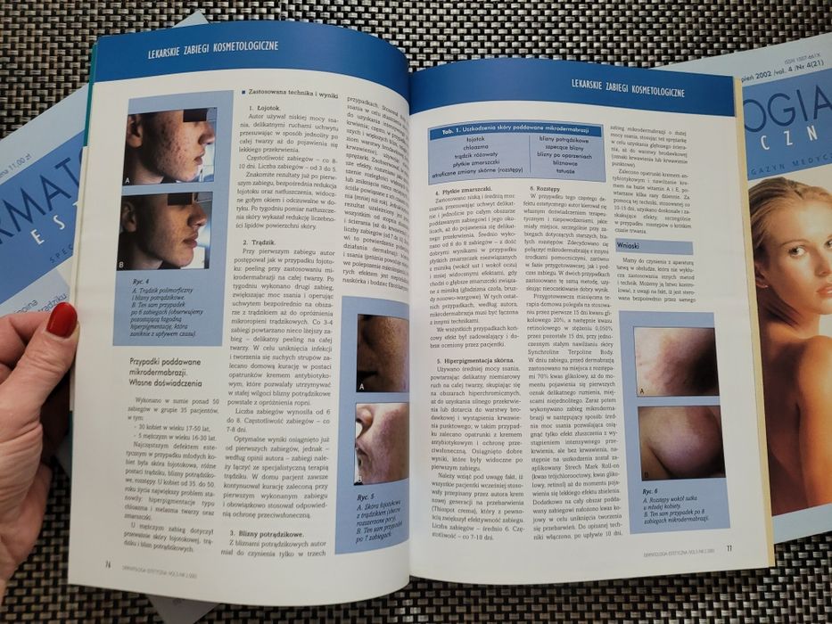 Czasopisma Dermatologia Estetyczna