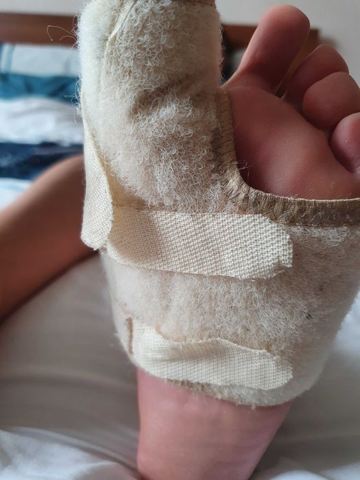 Бандаж(левый) при вальгусной деформации,травмах первого пальца.