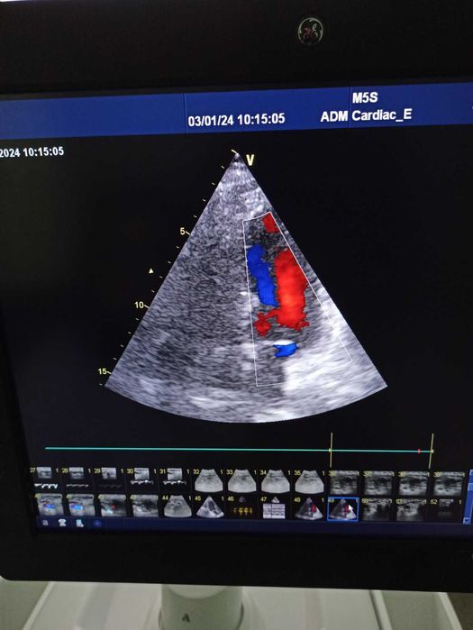 Експертна кардіосистема GE Vivid E9 (2016) M5S-D, 11L-D, 4C-D