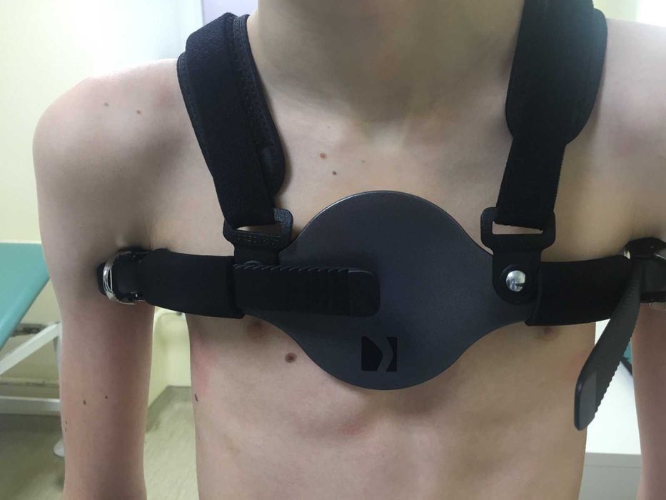 Ортопедичний корсет для грудної клітки