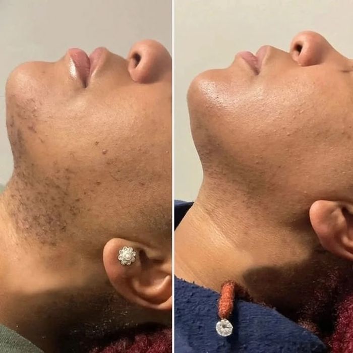 Tratamento natural " PELE E CABELO "