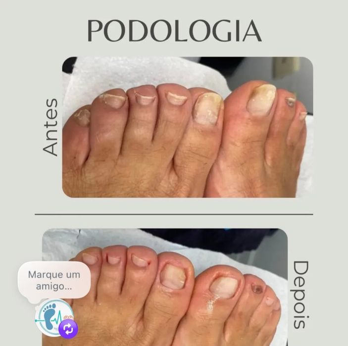 Pedicure avançada profissional