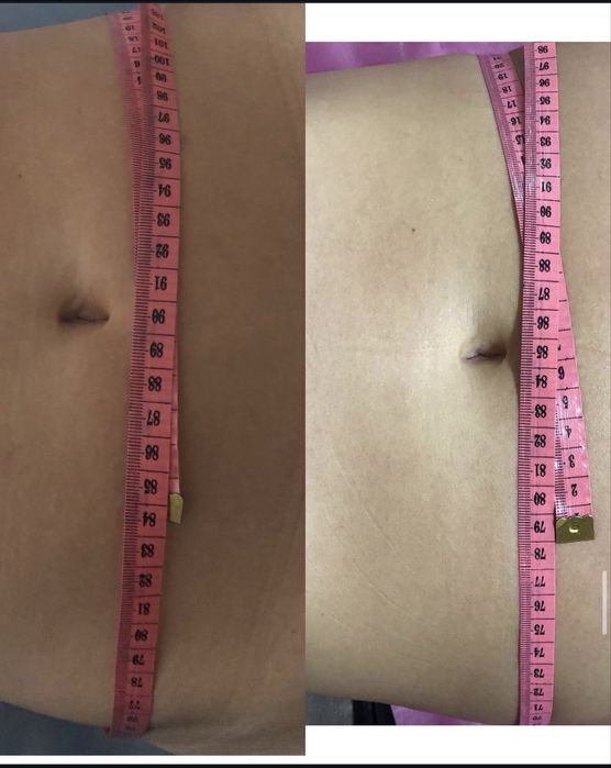 Професійний Ручний та Апаратний масаж Лівий берег Киів