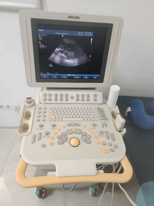 УЗД аппарат експертного класу Philips HD11XE