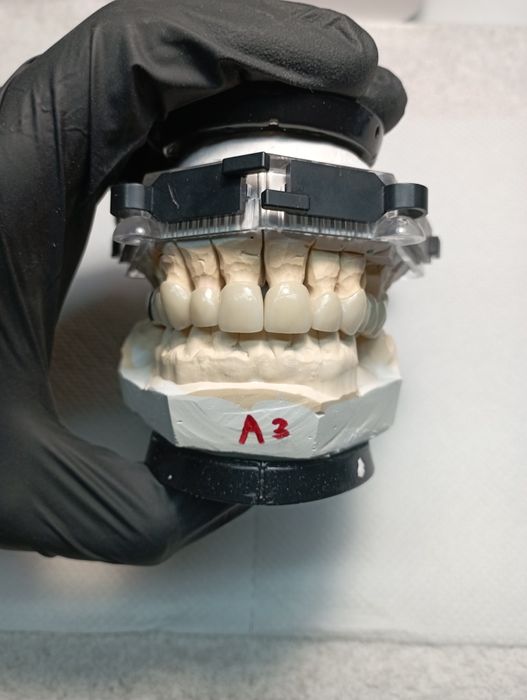 Зубний Технік /Металокераміст