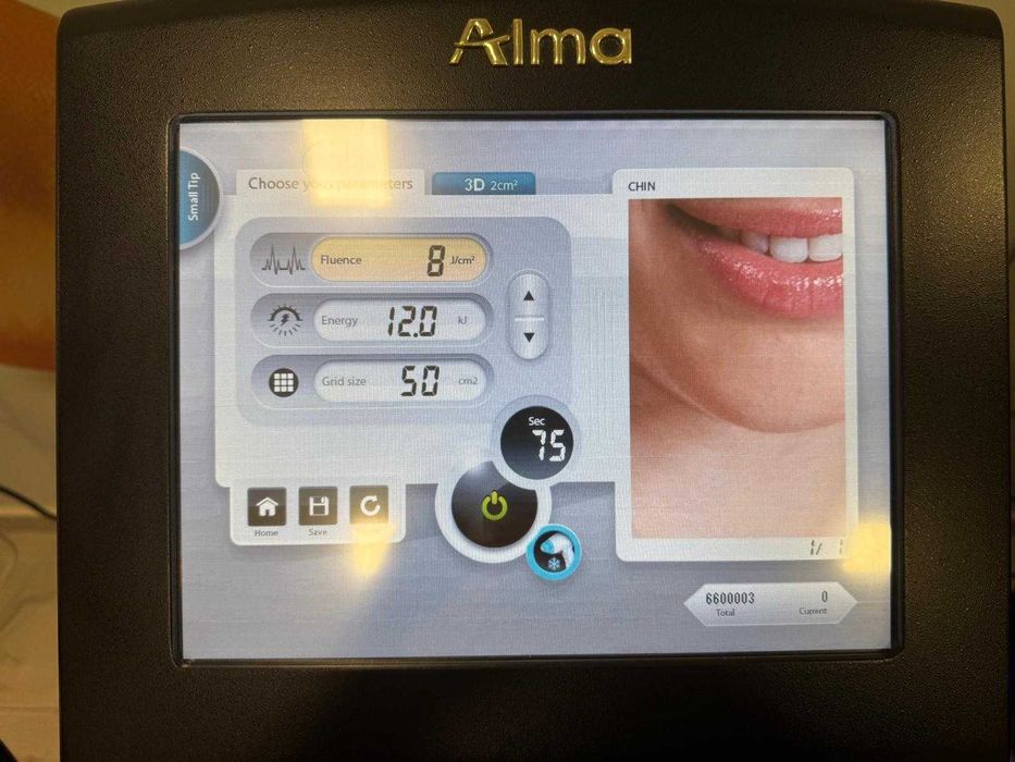 Laser Soprano ICE Platinum