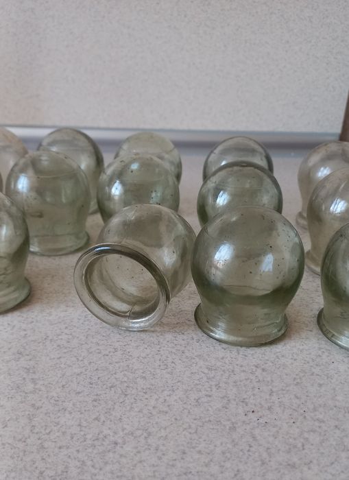 Продам комплект лікувальних банок