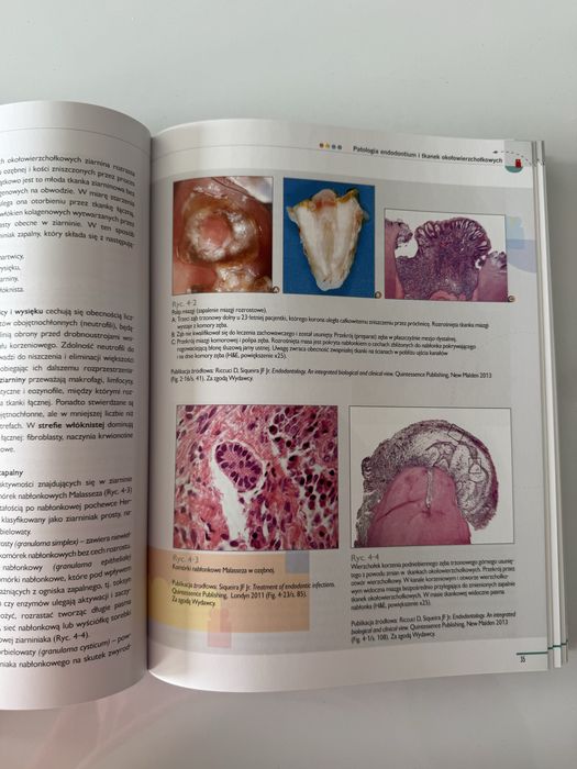 endodoncja Halina Pawlicka Mariusz Lipski quintessence