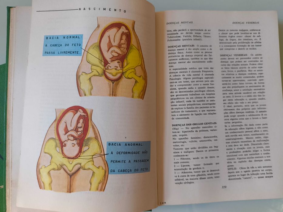 Coleção SAV - Sexo Amor e Vida (em 4 volumes)