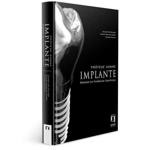 Livro Prótese Sobre Implante - Baseado em Evidências Científicas