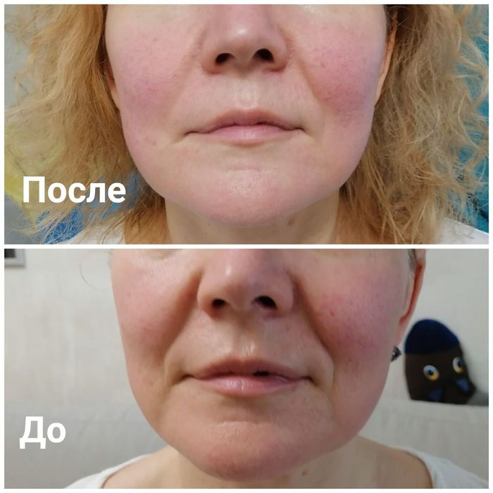 Massage. Массаж тіла та обличчя