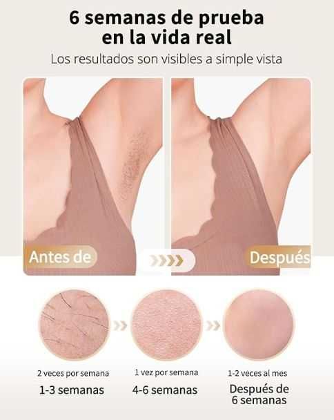 Depiladora Laser - Luz Pulsada (Nunca USADA)