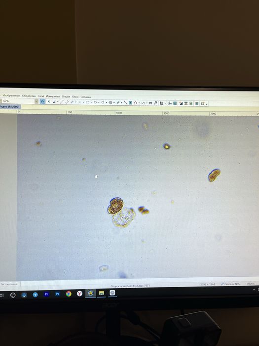 AmScope MU500 microscope camera