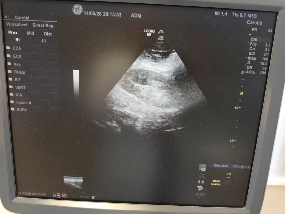 Ecógrafo GE Logiq E9 com 3 sondas originais GE