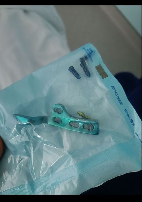 Титанова пластина для правої ключиці з документами